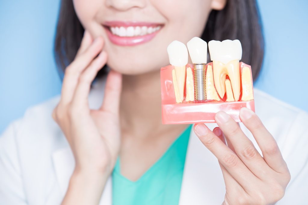 Restore Your Smile with Dental Implants: Your Trusted Experts in Grand Rapids Oral Surgery Associates of Grand Rapids dental-implants-experts-in-grand-rapids