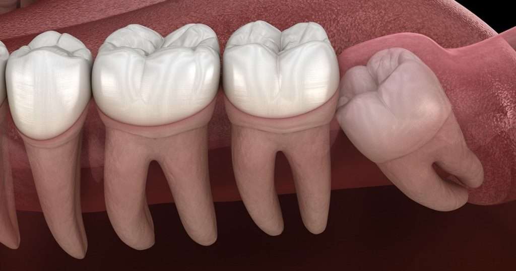 August01 blog featured image oral surgery associates Oral Surgery by Oral Surgery Associates of Grand Rapids