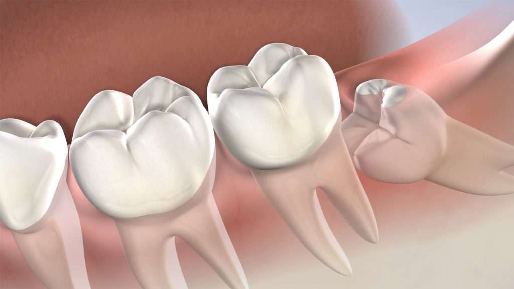 July01 blog featured image oral surgery associates Oral Surgery by Oral Surgery Associates of Grand Rapids
