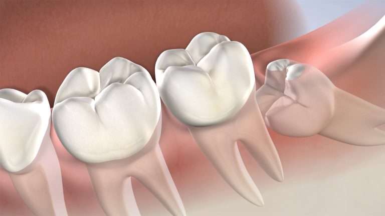 July01 blog featured image oral surgery associates Oral Surgery by Oral Surgery Associates of Grand Rapids