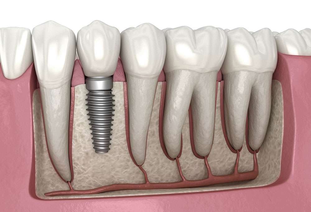 april01 blog featured image oral surgery associates Oral Surgery by Oral Surgery Associates of Grand Rapids