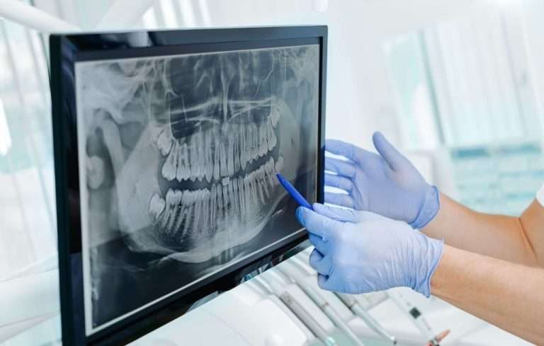may02 blog featured image oral surgery associates Oral Surgery by Oral Surgery Associates of Grand Rapids
