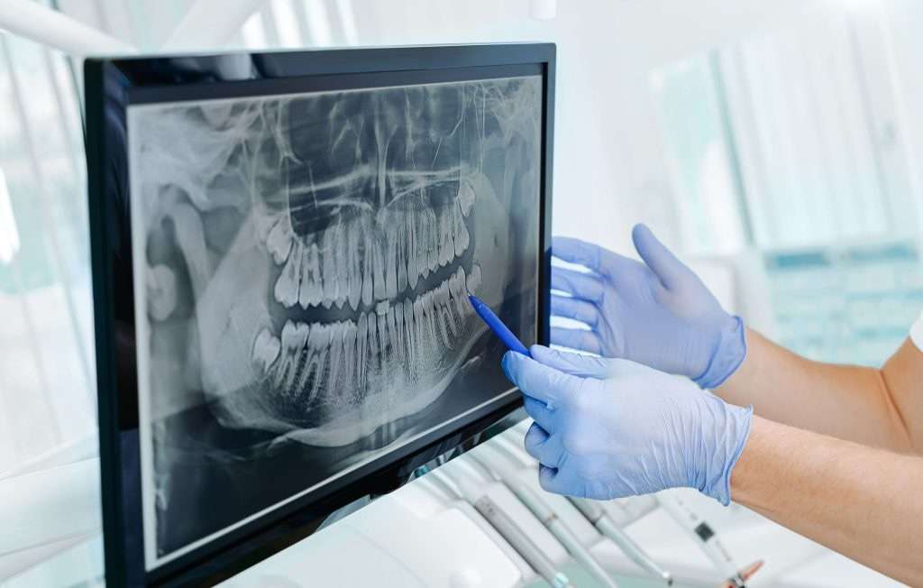 may02 blog featured image oral surgery associates Oral Surgery by Oral Surgery Associates of Grand Rapids
